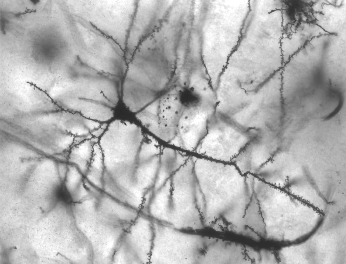 A stained pyramidal neuron from the hippocampus, its dendrites branching outwards